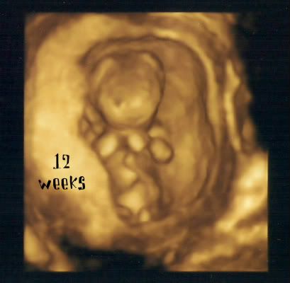 3d ultrasound pictures at 12 weeks. My regular u/s can flip to 3D