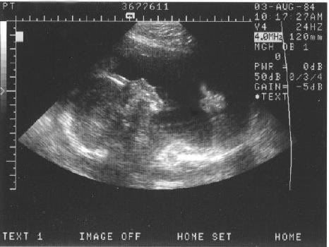 [http://i7.photobucket.com/albums/y282/stevenvaladez/Stuff/StevenSonogram.jpg]